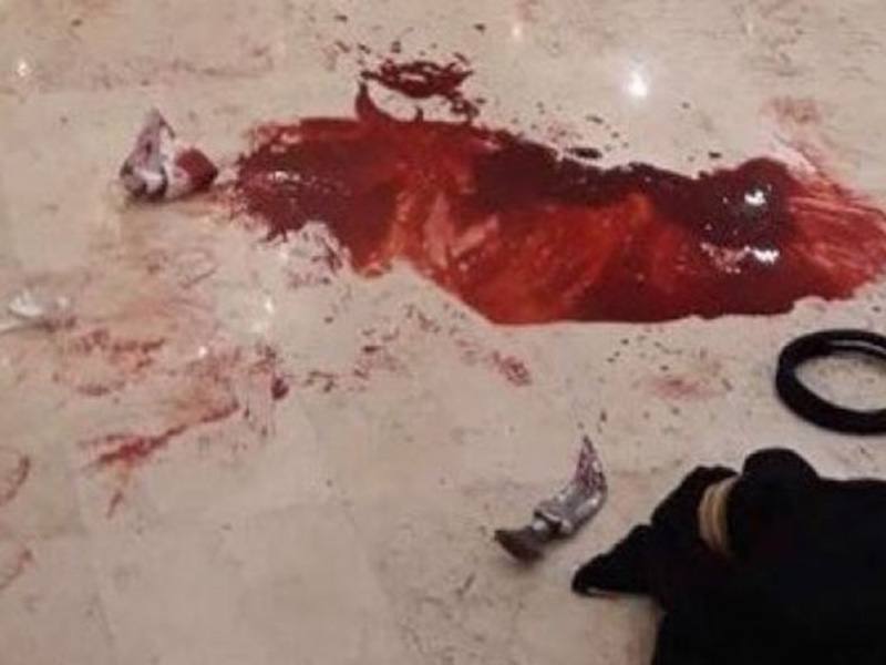 اضغط لمشاهدة الفيديو: طعن عريس سعودي يوم زفافه!